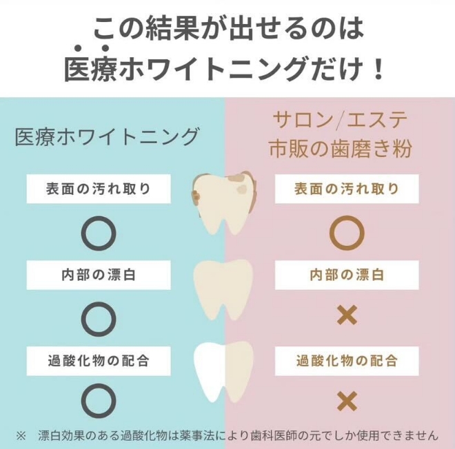 サロンホワイトニングと医療ホワイトニングは何が違う?